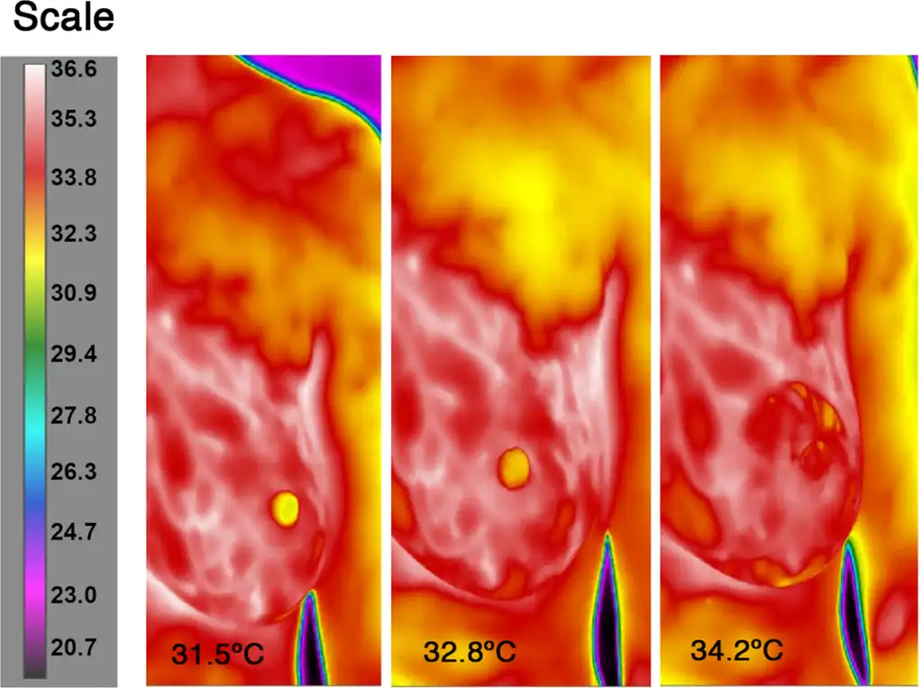 Temperatuur tepel